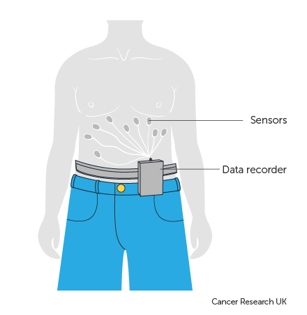 Diagram showing sensors and data recorder - capsule endoscopy