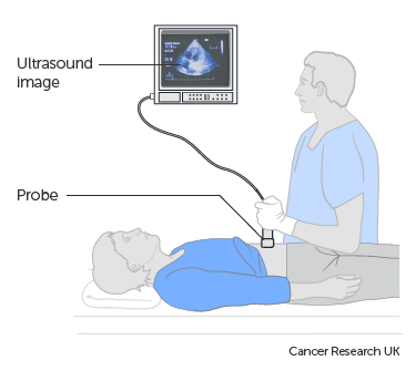 Diagram of an abdominal ultrasound