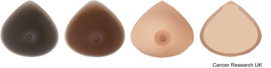 Photograph of permanent breast prosthesis in various skin tones.