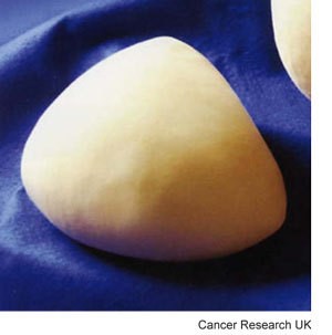 Photograph of a temporary breast prosthesis
