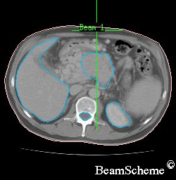 CT scan cross section 