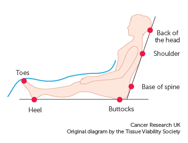 https://about-cancer.cancerresearchuk.org/sites/default/files/thumbnails/image/Diagram-showing-the-areas-of-the-body-at-risk-of-pressure-sores-when-sitting.png